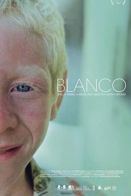 Blanco