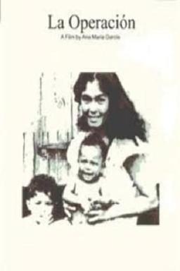 La operación