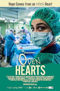 Open Hearts