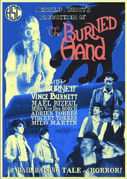 The Burned Hand
